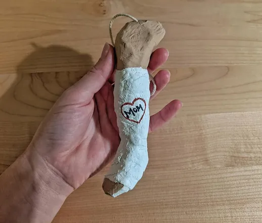 A leg in a little plaster cast signed “Mom”, made as an ornament